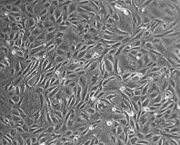 HK-2 Lidské ledvinné buňky (Human Kidney cell line), je buněčná linie ledvinných proximálních tubulárních buněk (viz Obr. 8), které byly získány z ATCC.