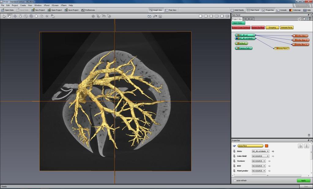 Obr. 7: Screenshot softwaru Avizo, žlutě je rozpracovaná segmentace cévního