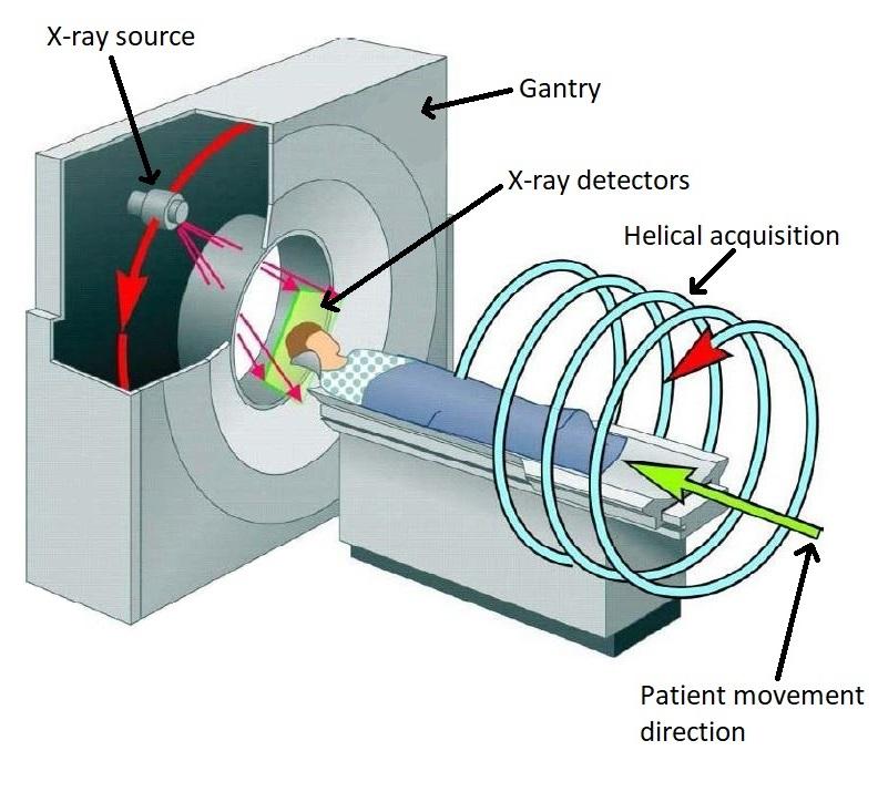 Fig. 2.2: Scheme of x-ray CT scanner and patient data acquisition [23]. blurred and the airways and vascular system are sharper than using conventional chest CT.