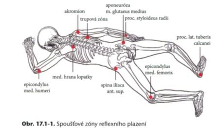 SPOUŠŤOVÉ ZÓNY REFLEXNÍHO PLAZENÍ 6 = procesus styloideus radii, asi 1 cm kraniálně: záhlavní HK, směr tlaku je do lokte. 7 = mediální kondyl femuru: čelistní DK, směr tlaku je do čelistního KYK.