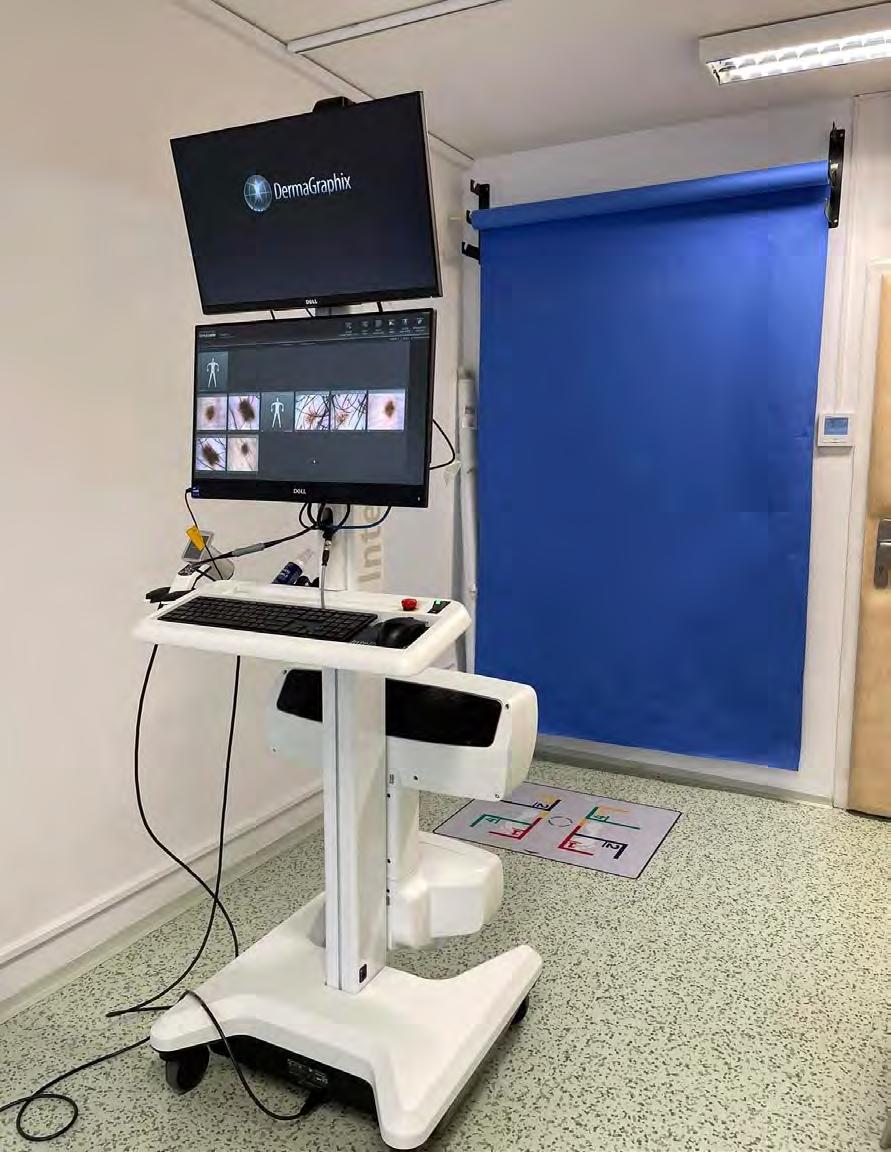Digitální dermatoskop Vyšetření ručním dermatoskopem s mnohonásobně větším zvětšením (až 70 ) a vysokou kvalitou obrazu.