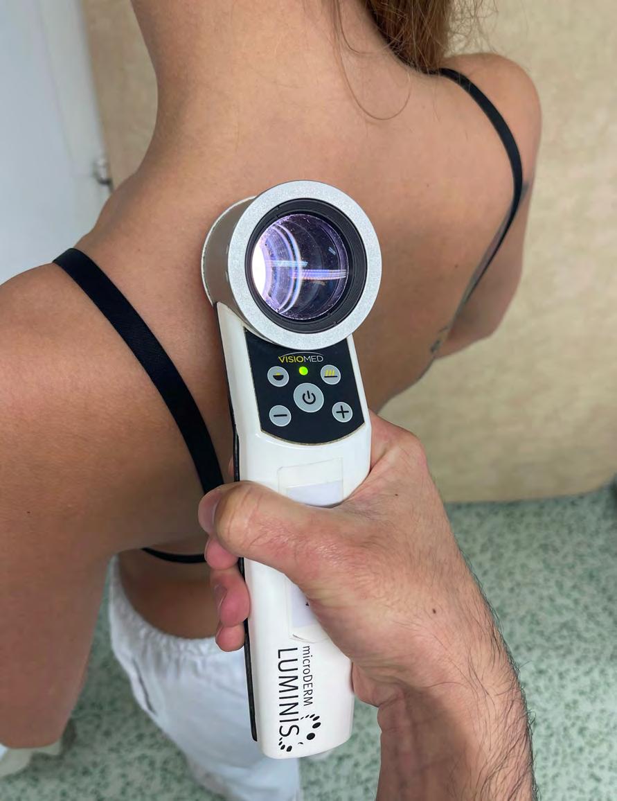Dalším velkým plusem digitálního dermatoskopu je možnost pořizování fotografií a jejich archivace. Vybrané névy jsou uloženy do databáze a porovnávány při tzv.
