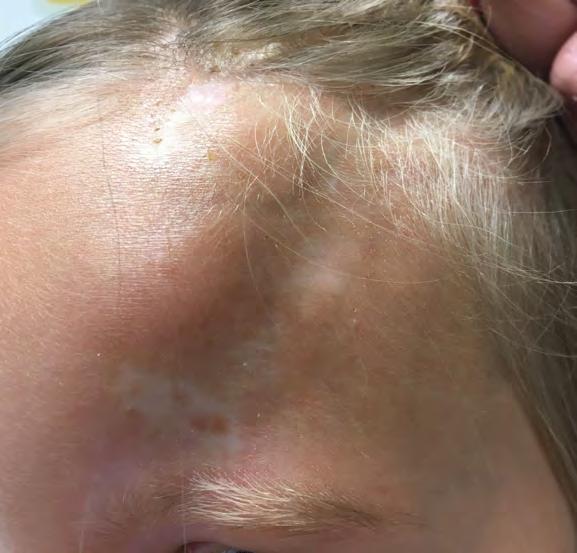 Jako jediné pracoviště dětské dermatologie v republice disponuje vlastní lůžkovou částí. Kromě běžné ambulantní péče provádí superkonziliární a konzultační činnost pro nejzávažnější případy.