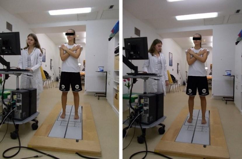 vizuální nebo proprioceptivní percepce a tím pádem ke ztížení podmínek pro udržení stability stoje.