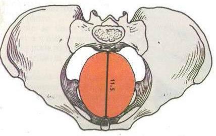 transversa, obliqua aditus pelvis promontorium, linea terminalis, horní okraj