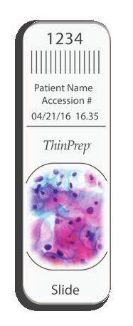 Hologic, Aptima, Genesis, Genius, ThinPrep and