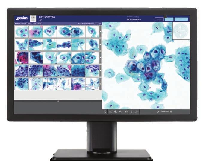 Explore the system. Hologic BV, Da Vincilaan 5, 1930 Zaventem, Belgium. ADS-03811-EUR-EN Rev. 001 2022 Hologic, Inc. All rights reserved.