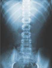 Úvod Algický bederní syndrom - Bolest zad - terminologie, definice Dělení bolestí zad Etiologie a diagnostika chronických bolestí zad