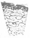 Basal bone cancellous 0 Alveolar bone Alveolar bone cortical cancellous Basal bone cortical Basal bone cancellous Obr. 6.