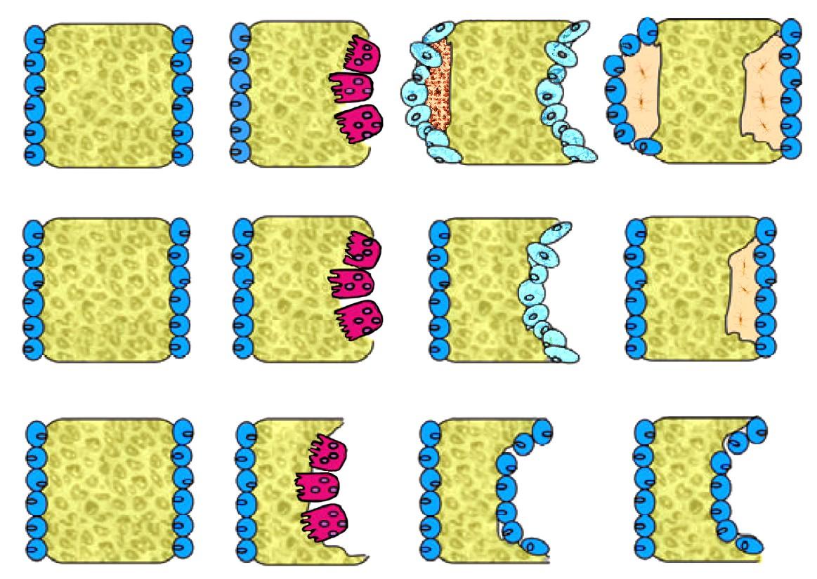 osteoblast osteocyt osteoid nová kost tvorba V kosti probíhající změny jsou v závislosti na zatížení.