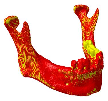 Na internetu je možné nalézt řadu odkazů na stažení CT/MR dat [200], [226], [205]. Na čelisti, která byla skenována na 3D skeneru byl pořízen i CT záznam.