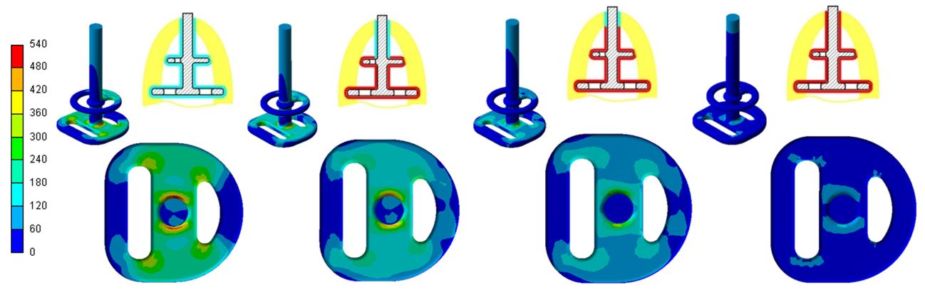 Na Obr. 10.19 je Ilustrativně vykresleno řešení pro zcela nepřirostlé implantáty (stádium oseointegrace I) a modul pružnosti spongiózní kosti 100 MPa.