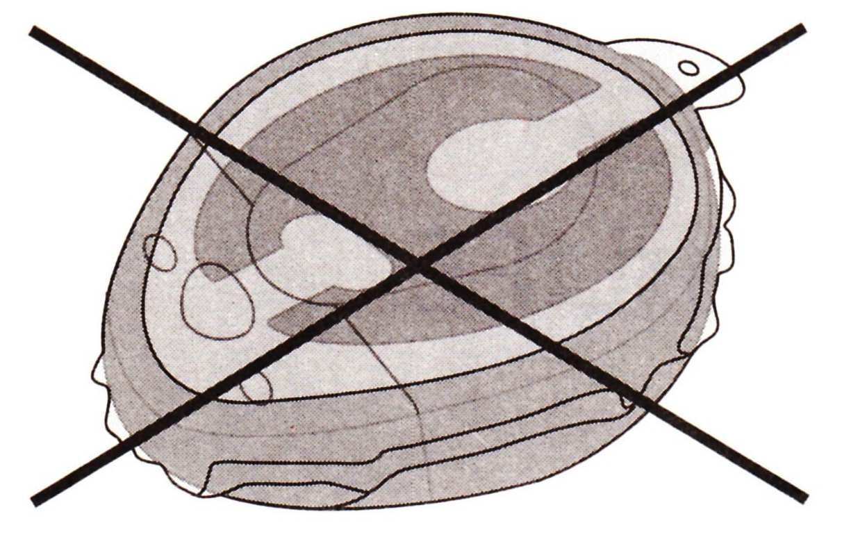 6. Umístěte RONDO v krytu WaterWear nad implantát.