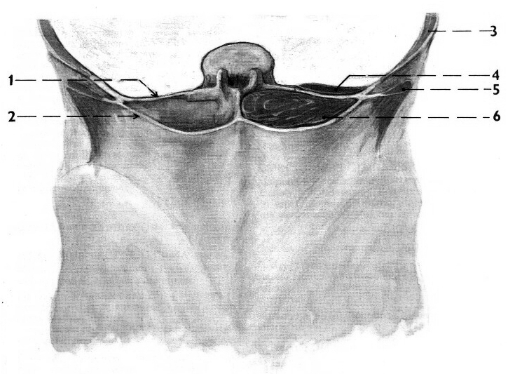 ZÁDOVÉ SVALY; povrchová vrstva a druhá vrstva, vpravo dole odkryta třetí vrstva a povrch vrstvy čtvrté 1 m. semispinalis capitis 2 m. splenius capitis 3 m. levator scapulae 4 m. rhomboideus minor 5 m.