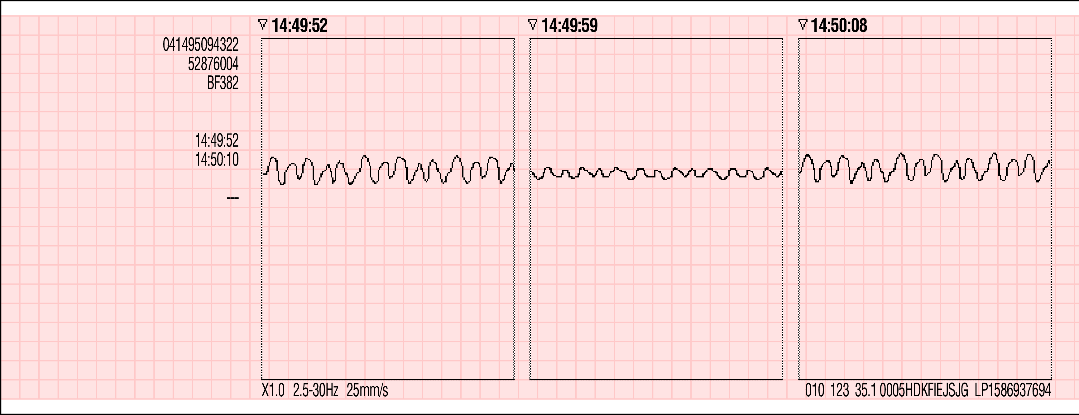 Událostem spojeným s křivkami předchází záhlaví, které obsahuje tyto informace: Patient data (Data pacienta), Vital signs (Životní funkce), Event name (Název události), Device configuration