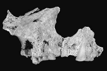 Archeologické rozhledy LXII 2010 305 a b Obr. 6. Třeboradice, obj. 3. Skelet 1, maxilla: a abnormální opotřebení všech zobrazených zubů 13, 14, 15, 16, 23, 24, 25; b ostitická ložiska pod kořeny 14, 16 a 17 (černá šipka).