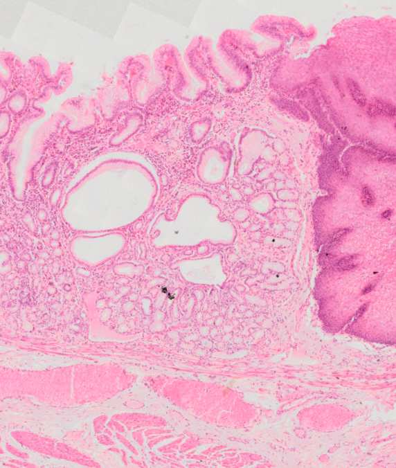 muscularis mucosae TS-t. submucosa TM-t.