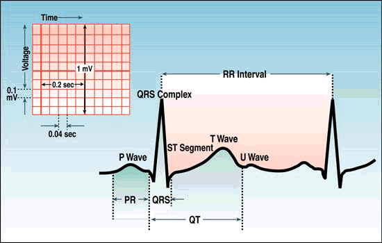 Měření EKG Výstupem z měření na elektrokardiografu jsou EKG křivky, zobrazované na stínítku obrazovky nebo zaznamenávané na vhodné medium (teplocitlivý nebo