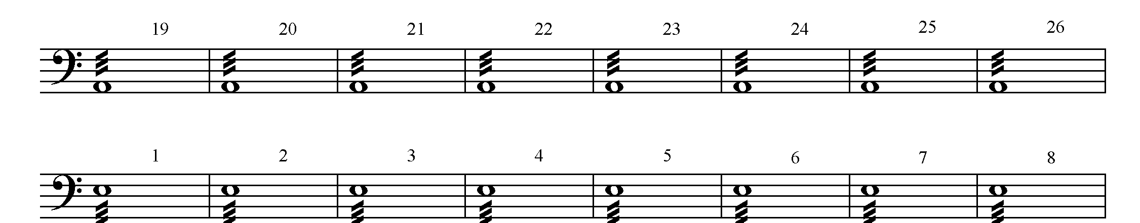 CD 2 Stopa 18. Bed ich Smetana Má vlast Šárka: Nástrojem, na kterém si budeme demonstrovat hru synkop v symfonické hudb jsou v této ukázce tympány.