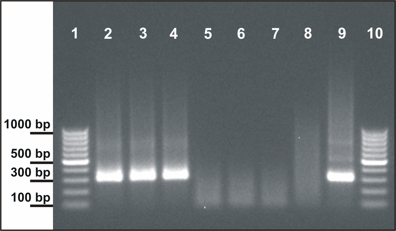 genotyp I (Obr. 7). Obrázek 7: Gel s PCR produkty z pacienta.