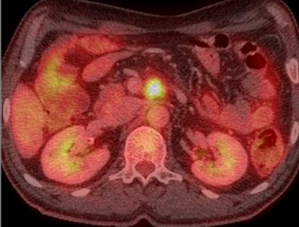 Vyšetřovací metody US, BKDUS MDCT MR, MRCP