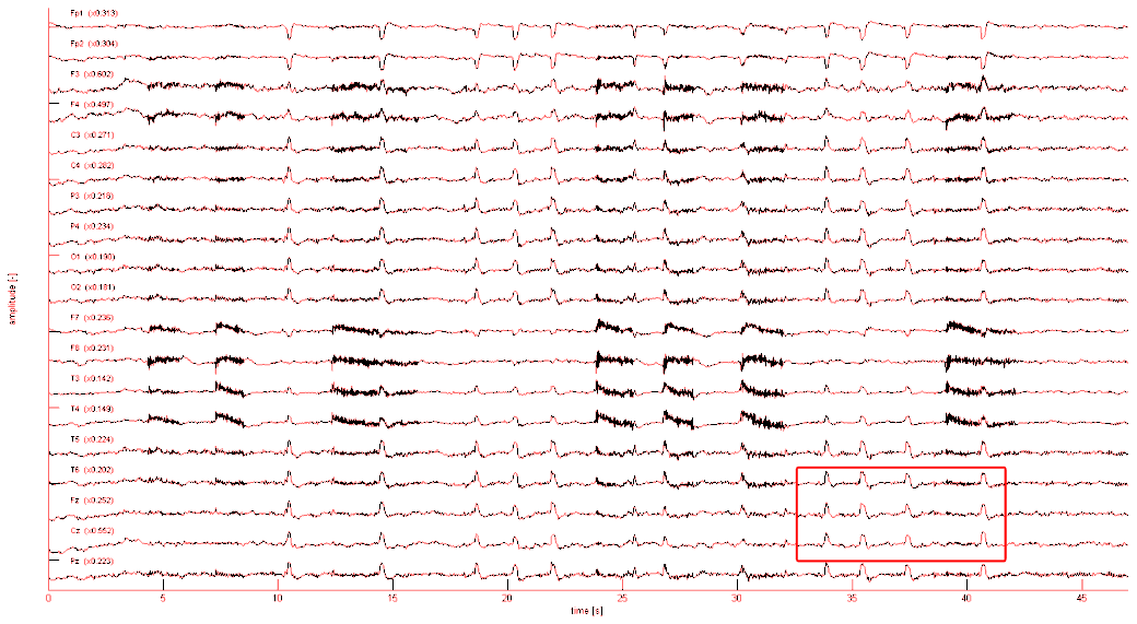 Odstranění rušení z rozvodné sítě (50/60Hz) zobrazení filtrace v