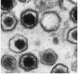 Úloha 1: První nahlédnutí do nanosvěta Novou část dějin mikroskopie otevřel německý elektroinženýr, laureát Nobelovy ceny za fyziku Ernst (1906 1988), který roku 1931 spolu s Maxem Knollem