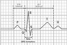 [5], [6] Měření elektrické aktivity srdce Ke Snímání EKG ve třídě můţeme pouţít EKG čidlo firmy Vernier, jejichţ snadné na ovládání umoţňuje pouţití ať uţ přímo v hodinách fyziky nebo při