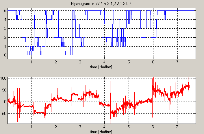 Nyní jsem aplikoval DFA na spánková data. Na Obr.12 je vidět vykreslená křivka složená ze součtu hodnot fast a solw. U tohoto případu křivka poměrně koresponduje s příslušným hypnogramem.