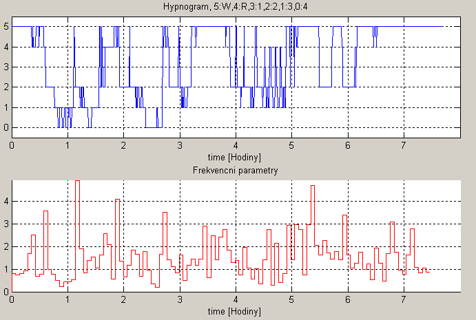 Obrázek 17: Frekvenční parametr LF/HF Frekvenční parametry jsou počítány po 256 sekundách. Charakterizují frekvenční spektrum v jednotlivých úsecích.