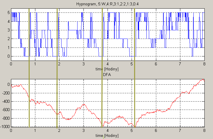Obrázek 20: Porovnaný výstup DFA s odpovídajícím hypnogramem (signál 025p04) Jak je vidět na obr.20 oba grafy mají lokální maxima a minima přibližně ve stejných místech.