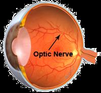 .. projev závisí na množství mitochondrií s mutací Příklady: 1) Leber s hereditary optic neuropathy (LHON) mutace v genech mtdna pro elektron transportní řetězec proteinů defect v enzymech oxidativní