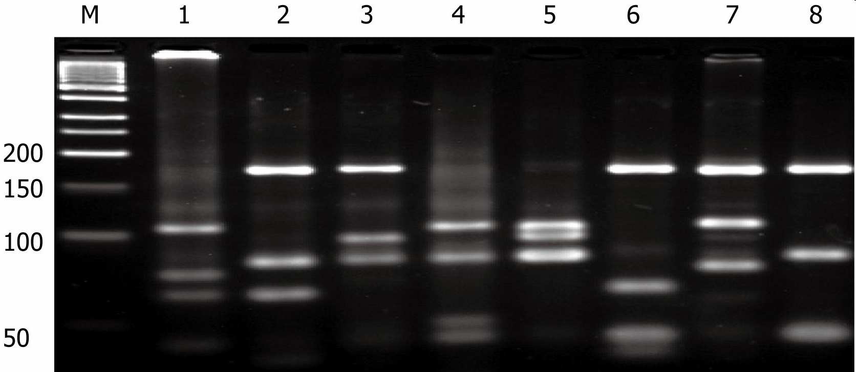 Konvenční PCR Konvenční PCR měření pouze výsledného produktu Není