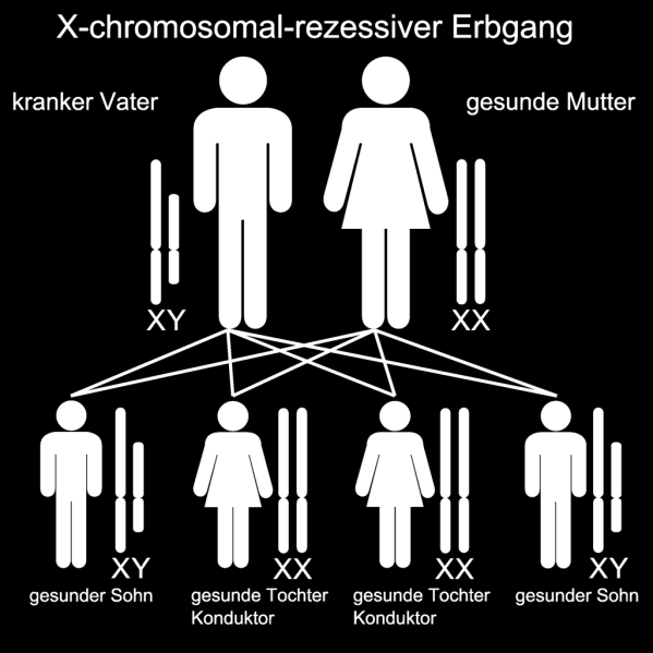 Primární imunodeficience Chlapci zhruba 2x častěji než dívky Často vázané na X chromozom