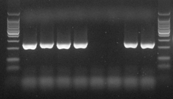 Optimalizace reakčních podmínek PCR - Změny v protokolu vedoucí k odstranění nežádoucích nespecificit a ke zvýšení množství PCR produktu.