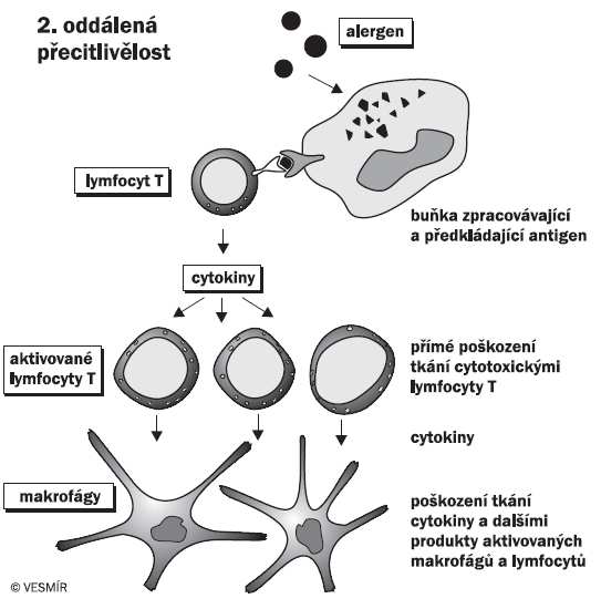 Nepříznivá reakce na potraviny nebo aditiva Potravinová alergie (imunologický mechanismus) Nealergická potravinová hypersenzitivita (neimunologický mechanismus - intolerance) IgE mediovaná non-ige