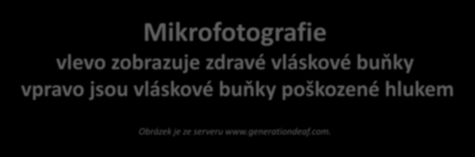 Mikrofotografie vlevo zobrazuje