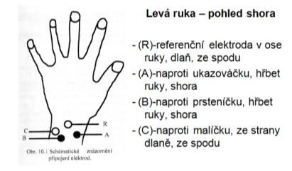 Současné snímání mozkových potenciálů se děje na počítačových systémech, které převádějí analogový (časově spojitý) signál na digitální, provádí digitální filtraci neţádoucích frekvenčních komponent,