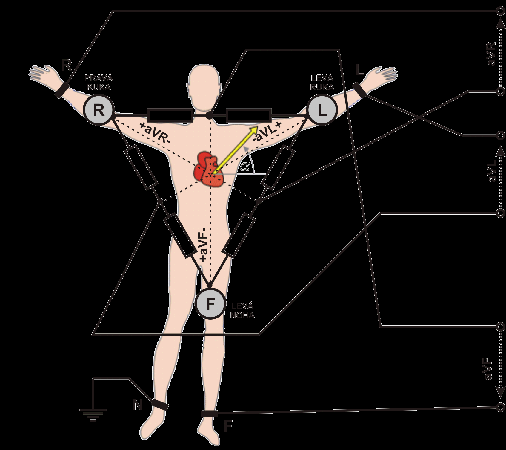 12-ti svodové EKG Napětí ve svodech: avr = R (L + F)/2 avl = L