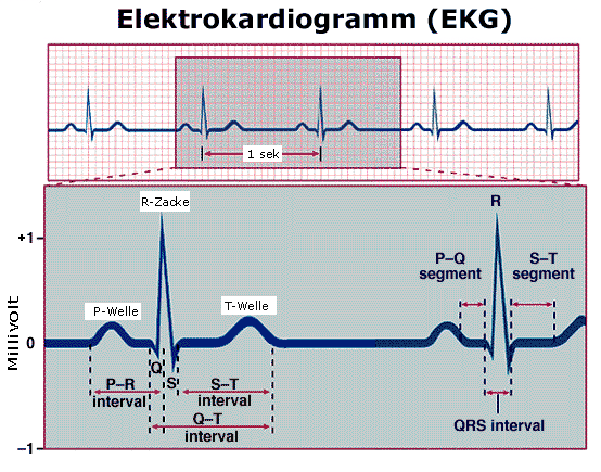 EKG ElektroKardioGram je záznam elektrické srdeční činnosti v závislosti na čase.