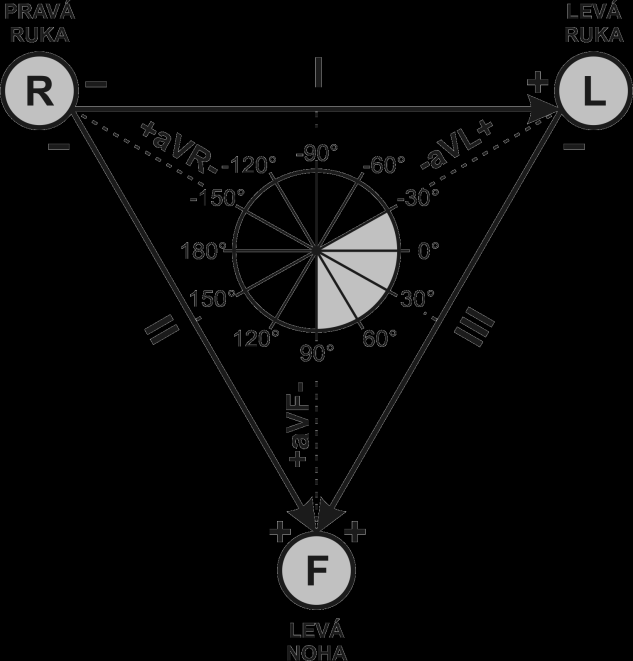 Einthovenovy (bipolární) svody Bipolární zapojení / snímá ze dvou elektrod /. Označíme-li pravou ruku písmenem R (right) a levou ruku L (left) signál L-R označujeme jako I.