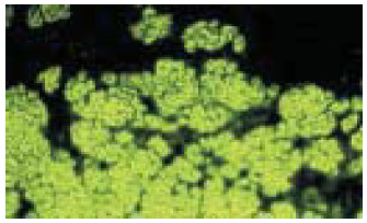 Obrázek č. 1: EMA fluorescenční reakce na opičím tkáňovém řezu hladkého svalu, 200x Jablkově zelená fluorescence endomysiálních linií u svazků hladkých svalů Obrázek č.