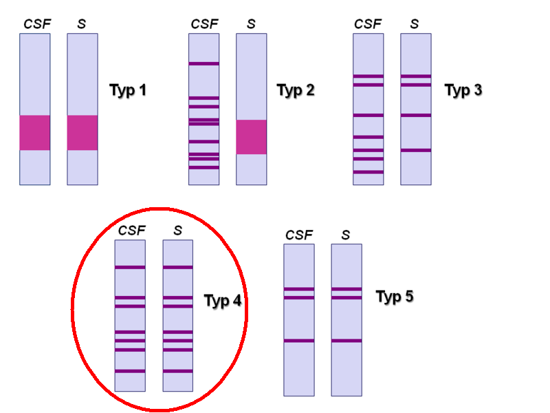 Likvor Cytologie (lymfocytární oligo- až pleiocytoza, 10-1000/3, přítomnost plazmocytů) Bílkovina (zvýšena), normální glykorhachie F-ce HLB (porucha HEB, QAlb > 7.5.