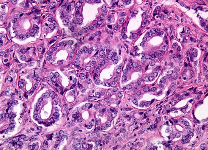 CPSE Specifická psí prostatická esteráza Marker časné benigní hyperplazie prostaty (BHP). Koreluje s objemem prostatické tkáně.