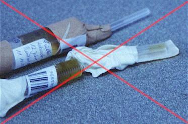 Způsoby odběru moči Odběr před zahájením terapie (antibiotika, infuze). K odběru čisté a prázdné odběrové nádobky.