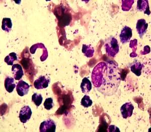 Kultivace moči Pro diagnostiku cystitid a pyelonefritid Vhodná je moč získaná cystocentézou Moč v nádobce
