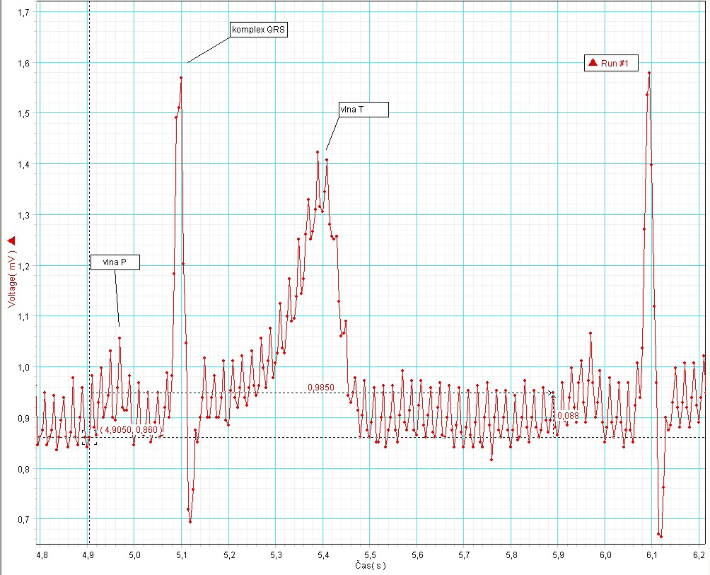 biologie Analýza srdeční aktivity pomocí EKG úloha číslo 05 Obr.