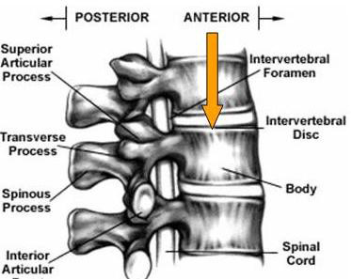 Tecnomatix JACK použité metody Lower Back Analysis Výpočet tlakových sil a smykových sil v oblasti L4/L5, distribuce