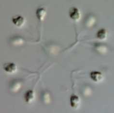 Fytoplankton rybníku Svět 1, 10 - Anabaena spiroides a její (trvalá spóra), 2 - Scenedesmus disciformis,