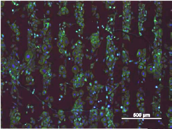 Cells on B-doped diamond (BNCD) BNCD from K.